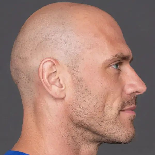{{NAME}} face, right profile