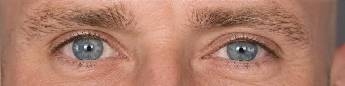 Close-up of {{NAME}} eyes